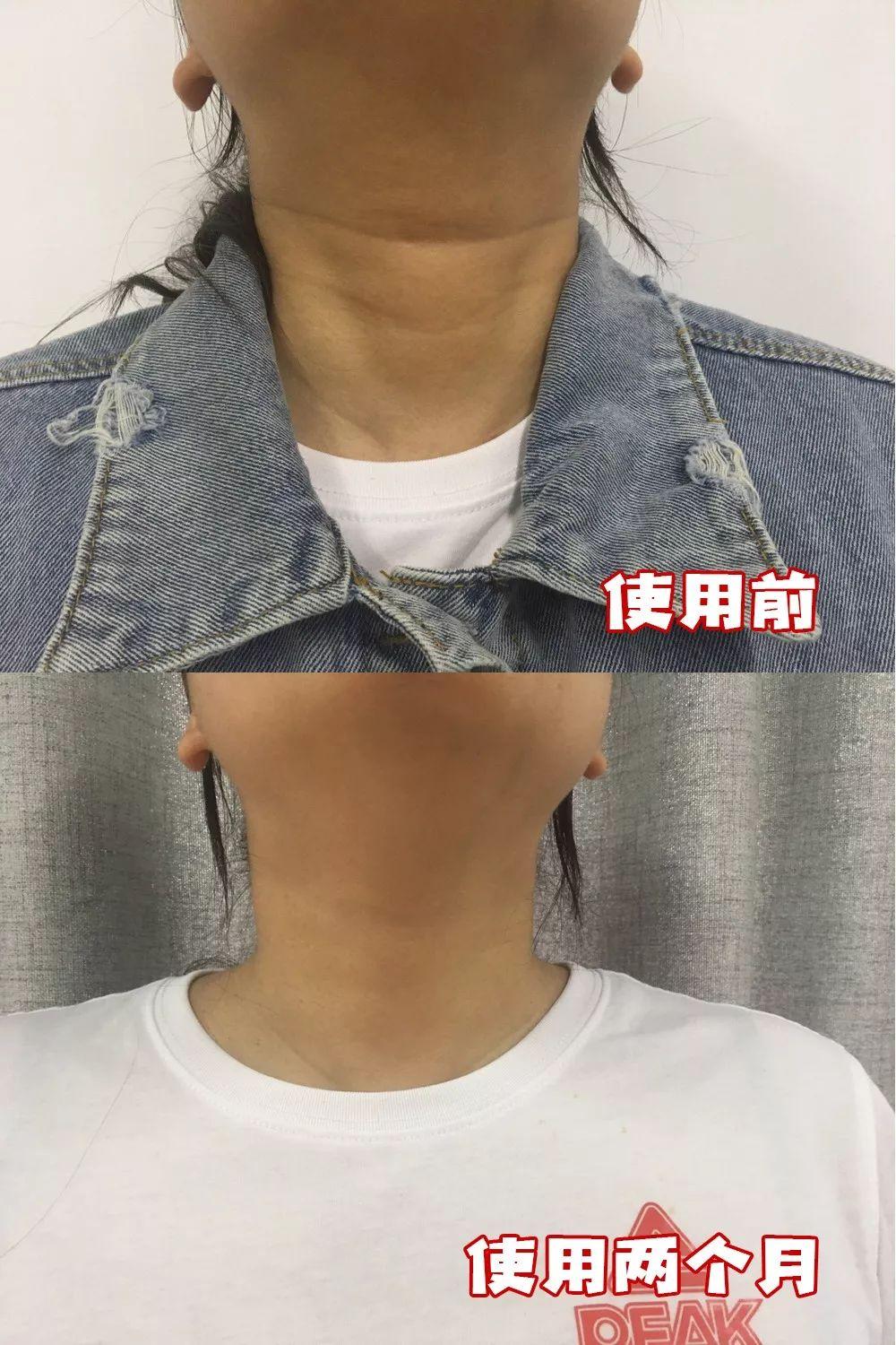 最新美容院儀器，重塑美麗的科技革新力量